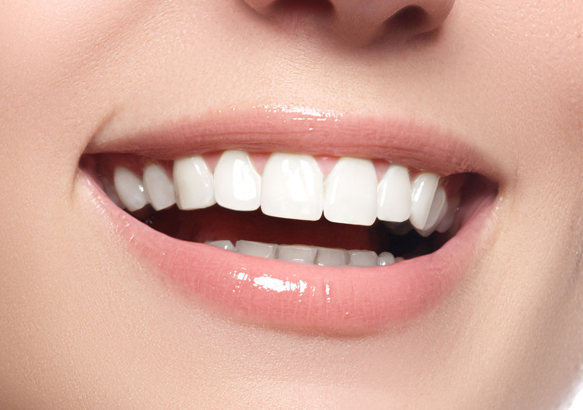 Effective Teeth Whitening in Centennial CO Area