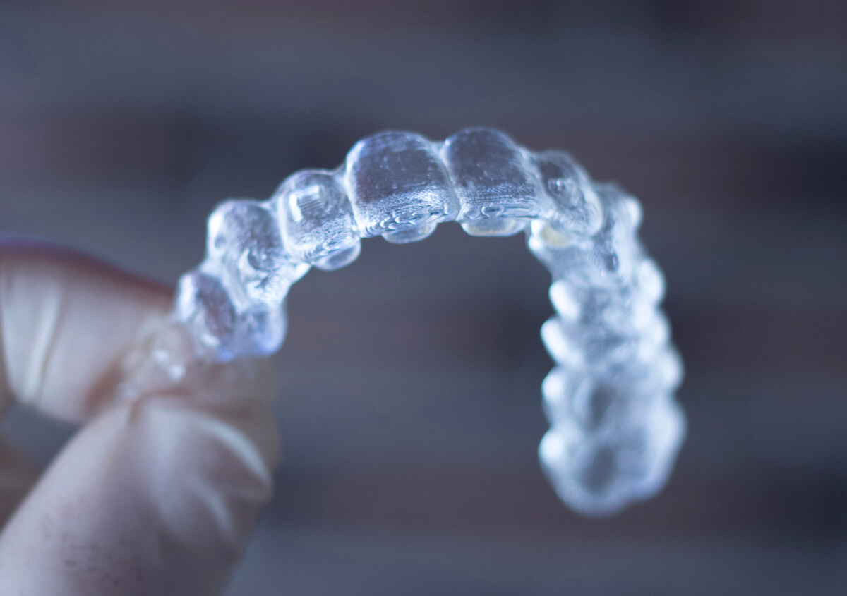 Clear Aligners for Teeth in Centennial CO Area